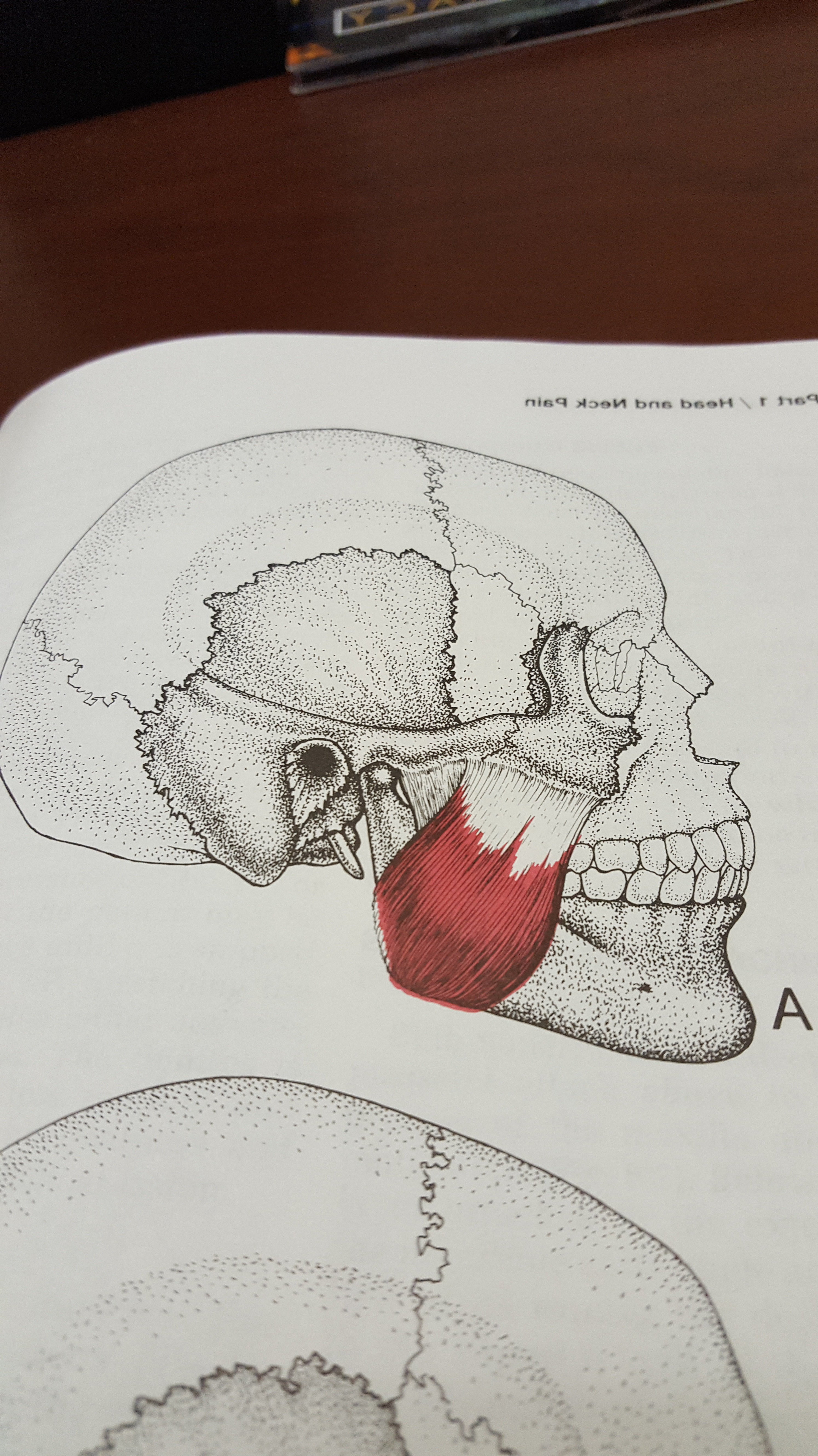 Tension Headaches: A Muscle Overlooked